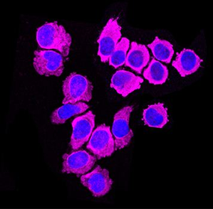 Examine Finds New Immune Cell To Assault And Get rid of Most cancers, Covid