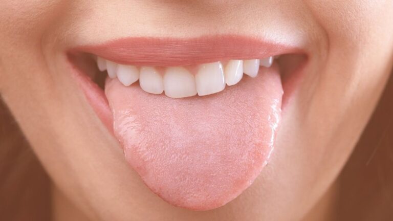 Scalloped Tongue Unveiled: Well being Alerts & Options