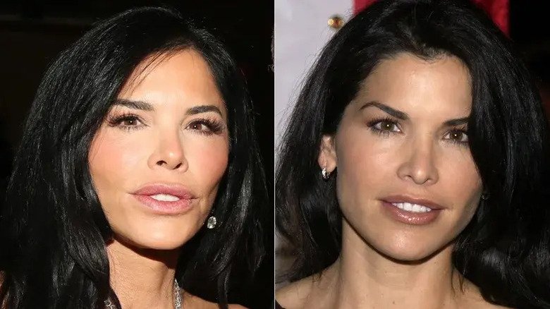 Lauren Sanchez's facial transformation